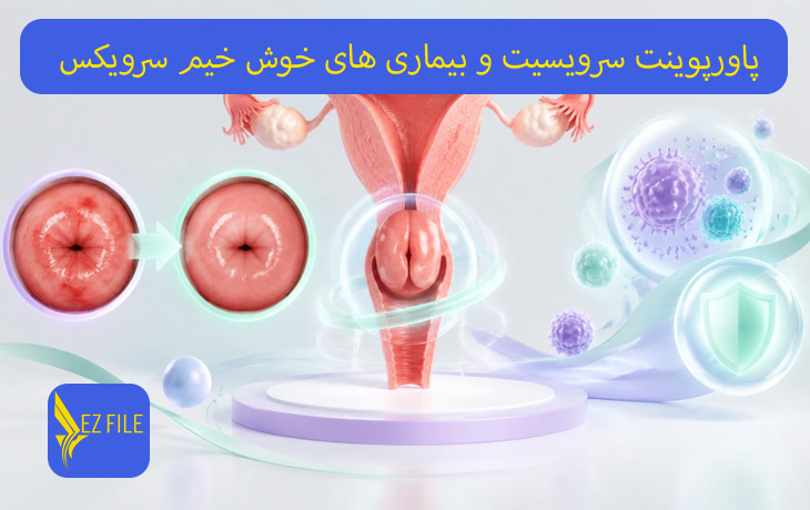 کاور محصول