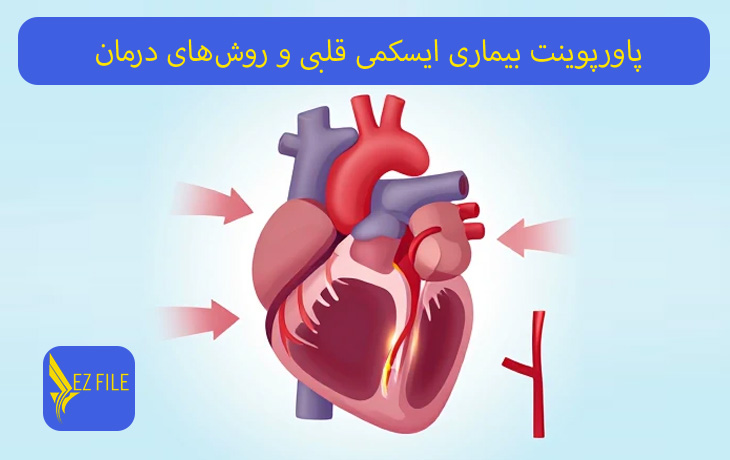 کاور محصول