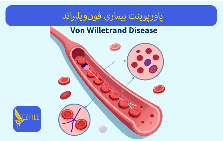 پاورپوینت بیماری فون‌ویلبراند