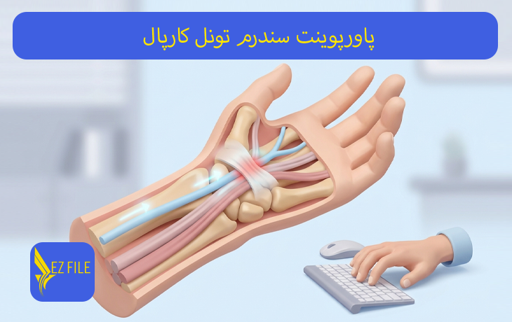 پاورپوینت سندرم تونل کارپال