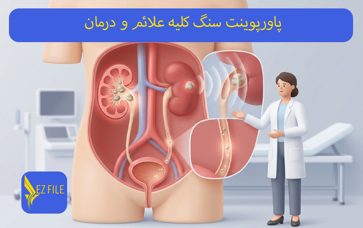 پاورپوینت سنگ کلیه علائم و درمان