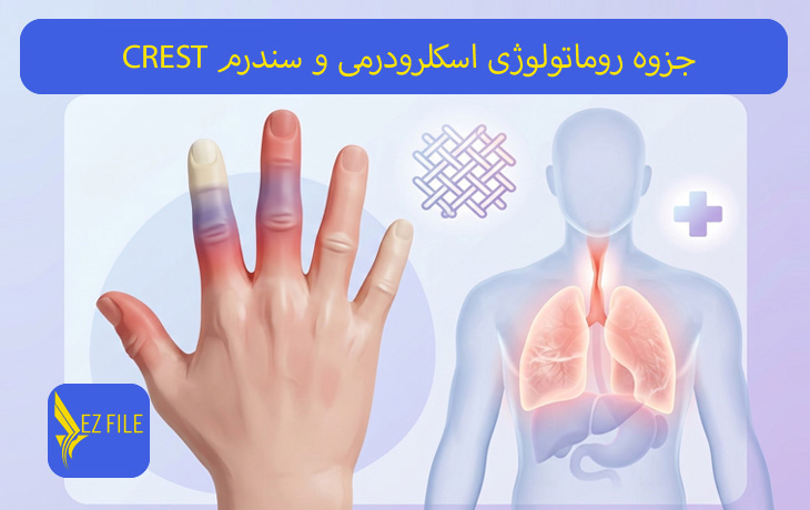 جزوه روماتولوژی اسکلرودرمی و سندرم CREST